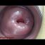 Uterus Penetration with Objects, Pumping Cervix Prolapse 2 min 720p